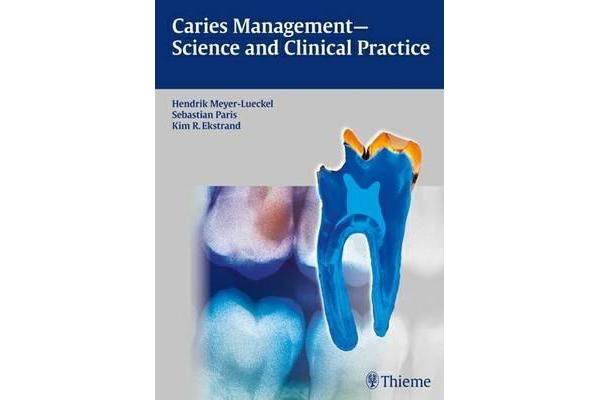 Caries Management - Science and Clinical Practice