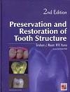 Preservation & Restoration Of Tooth Structure