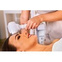 18 for a microdermabrasion treatment from hair and beauty spot