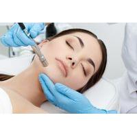£21 for a microdermabrasion treatment from Olivia\'s Beauty