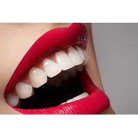 249 instead of 1000 for a porcelain veneer 449 for two veneers at dr m ...