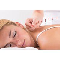 24 instead of 60 for a luxury massage acupuncture session from be heal ...
