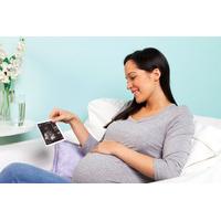49 instead of 99 for a 4d ultrasound package including photos dvd opti ...