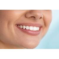 49 instead of 250 for one led teeth whitening session including a cons ...