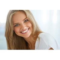 99 instead of 399 for a zoom teeth whitening treatment or 119 to inclu ...