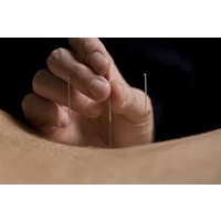 Acupuncture with Choice of Massage