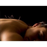 Acupuncture with Massage Session