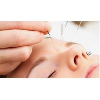 Acupuncture Diploma - Online Course