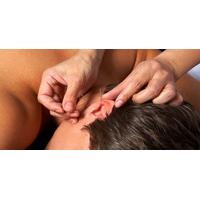 Auricular Acupuncture