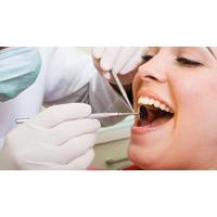 camden dental examination scale and polish with qualified dentist