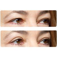 Easy Lift Eye Lift Strips