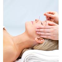 Facial Rejuvenation Acupuncture (more than one session required for results)