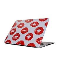 For MacBook Air Pro 11.6 13.3 15.4 inch Retain Case Cover Cartoon Drawing Painting Decorate Protector for New MacBook Kiss Pattern