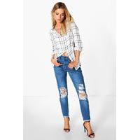 High Waisted Knee Rip Mom Jeans - mid blue
