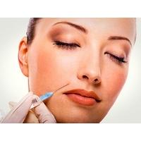 Juvederm Mini Face Lift