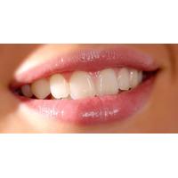 Natura White Teeth Whitening