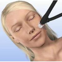 Non-Chemical Deep Peeling Facial with Led Light Therapy