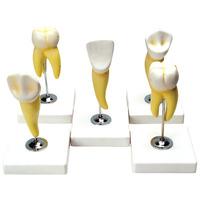 RVFM Classic Tooth Model Series