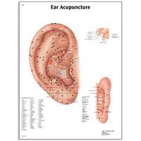 SEIRIN Ear Acupuncture Chart