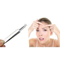 stainless steel blackhead extractor tool