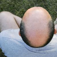 tradition chinese scalp massage