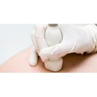 Ultrasound Cavitation and Radio Frequency Skin Tightening Treatment